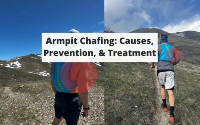 Armpit Chafing: Causes, Prevention, & Treatment